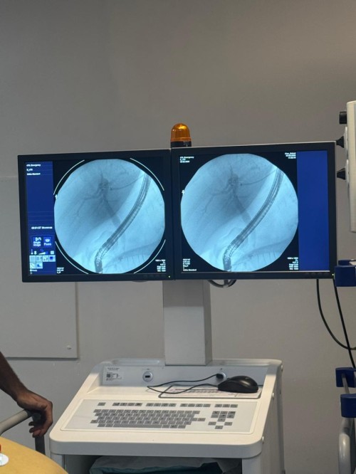 Hospital Santa Terezinha amplia acesso a procedimento de alta complexidade pelo SUS